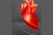 Cell Therapy No Help for Cardiac Recovery in HF Patients With LVADs